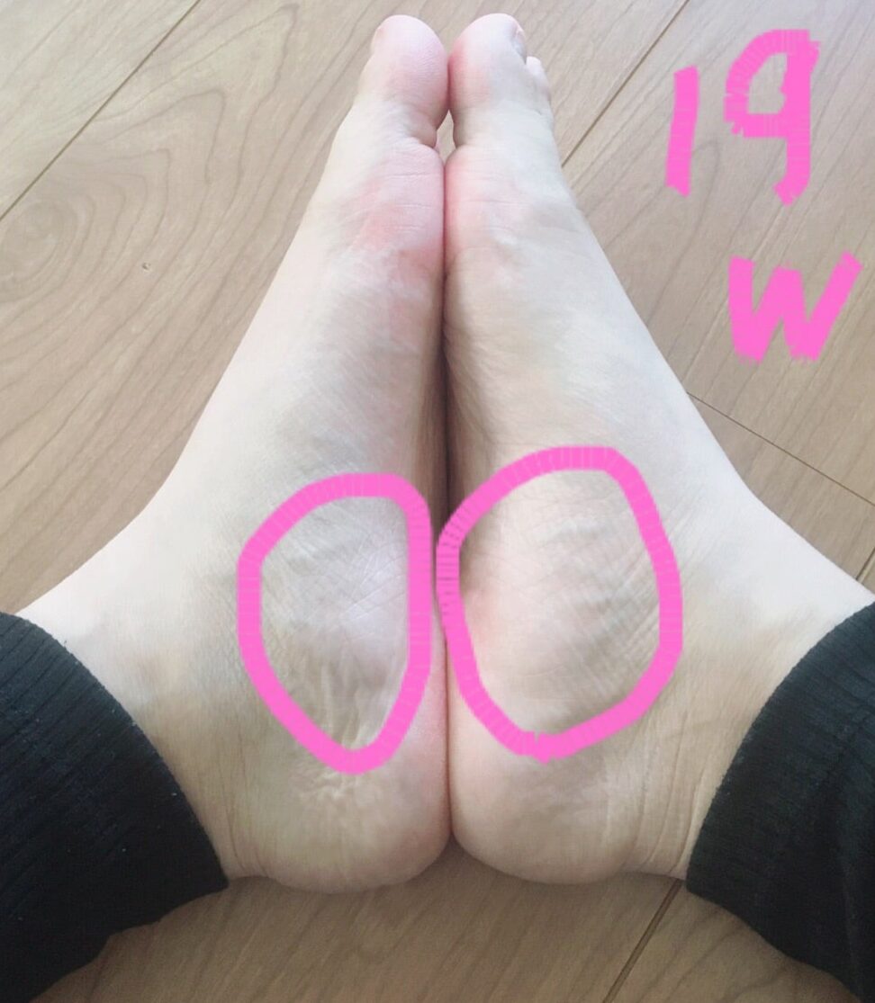 かかとで性別判断?赤ちゃんの性別がわかるジンクス 33 かかとで性別判断?赤ちゃんの性別がわかるジンクス