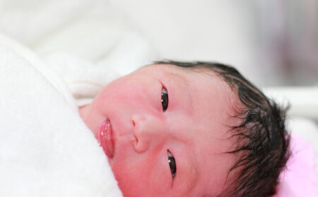 水頭症 赤ちゃん 見た目:症状と診断、治療法について解説 40 水頭症 赤ちゃん 見た目:症状と診断、治療法について解説