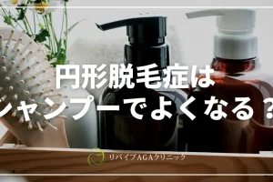 子供 円形 脱毛 症 シャンプー 効果的なケアとおすすめ製品の選び方 142 子供 円形 脱毛 症 シャンプー 効果的なケアとおすすめ製品の選び方